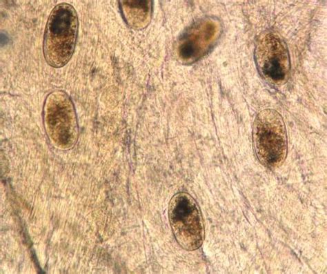  Metacercaria: A Tiny Trematode Terrorizing Tasty Fish!