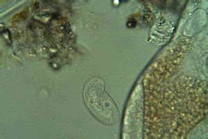  Chilodonella! An Intriguing Mastigophoran Microscopic Wanderer with Remarkable Adaptations for Aquatic Survival